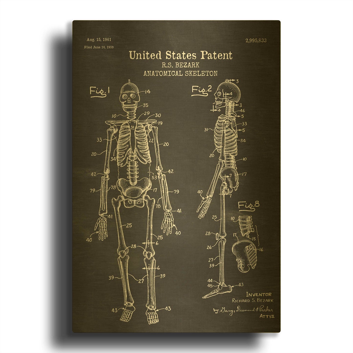 'Anatomical Skeleton Blueprint Patent Chalkboard' By LUXE Gold Metal Wall Art